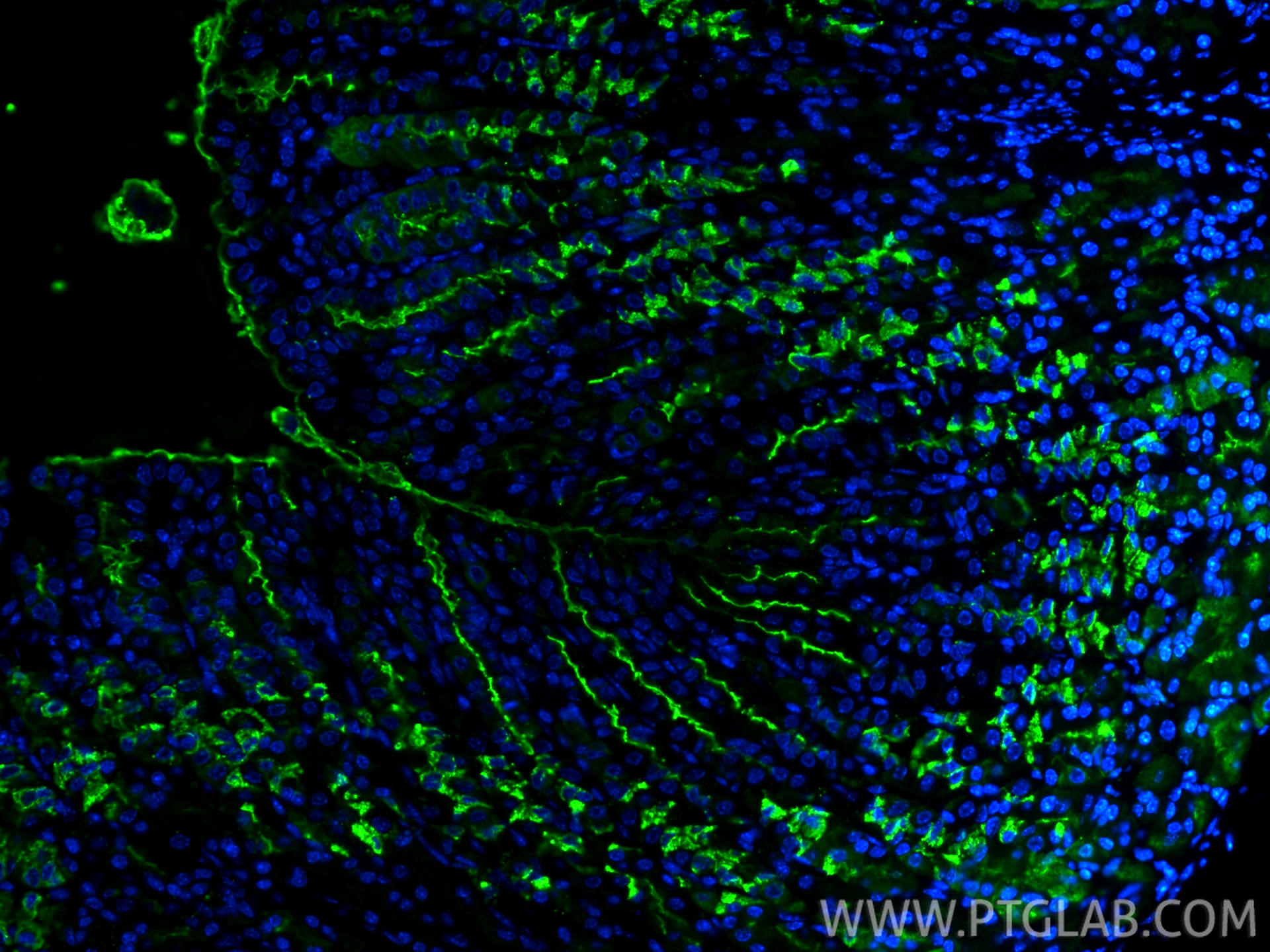 IF Staining of mouse stomach using 13681-1-AP (same clone as 13681-1-PBS) IF Staining of mouse stomach using 13681-1-AP (same clone as 13681-1-PBS)