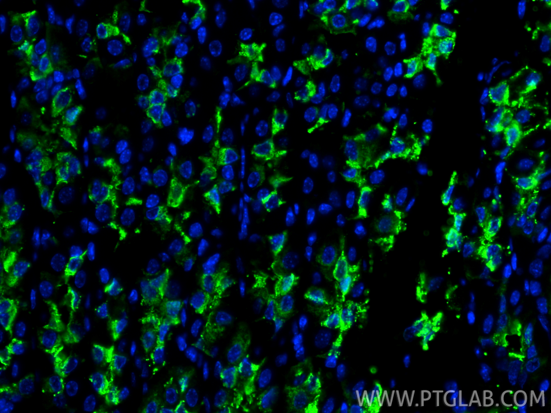 IF Staining of mouse stomach using 13681-1-AP (same clone as 13681-1-PBS) IF Staining of mouse stomach using 13681-1-AP (same clone as 13681-1-PBS)