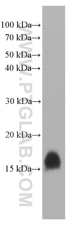 WB analysis of rat pancreas using 66471-1-Ig