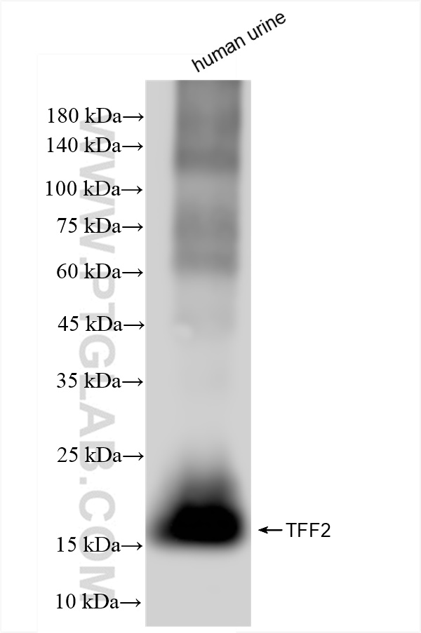 WB analysis of human urine using 83717-4-RR (same clone as 83717-4-PBS)