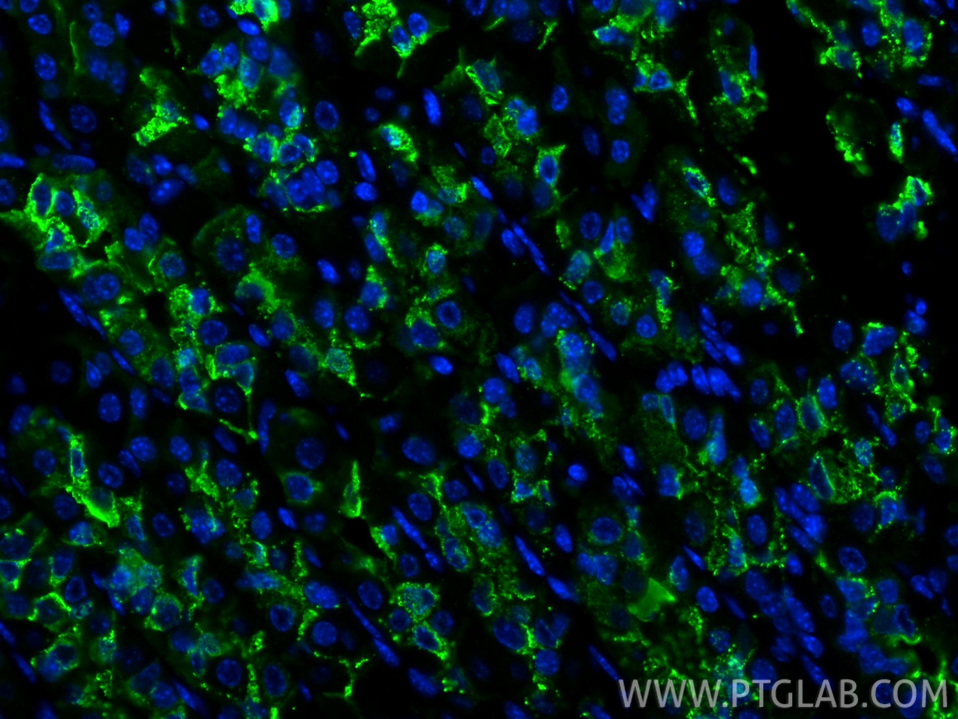 IF Staining of mouse stomach using CL488-13681 IF Staining of mouse stomach using CL488-13681