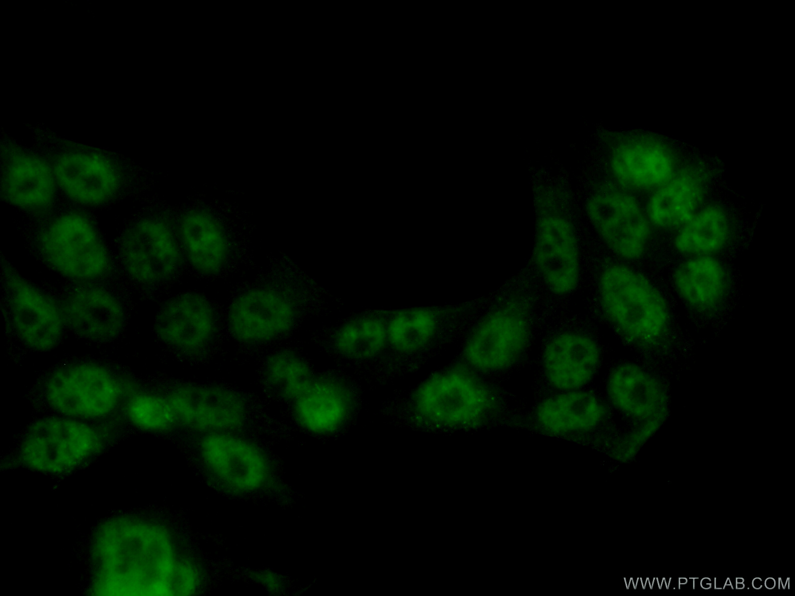 IF Staining of HeLa using 66114-1-Ig