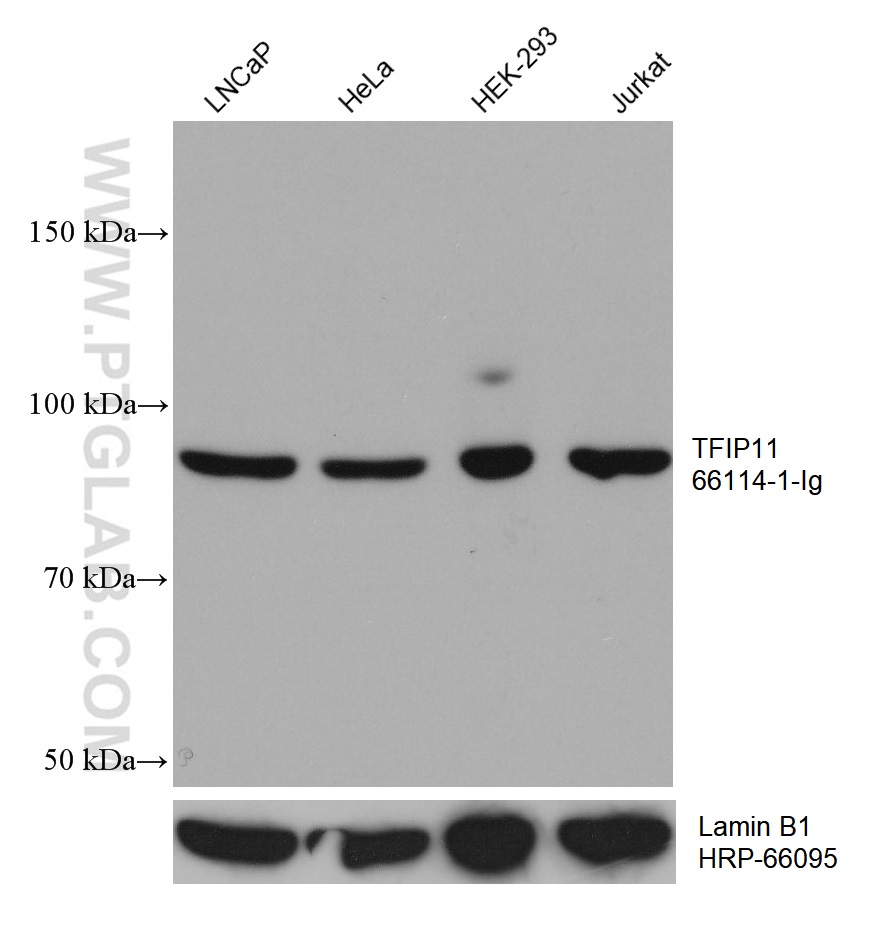 WB analysis using 66114-1-Ig