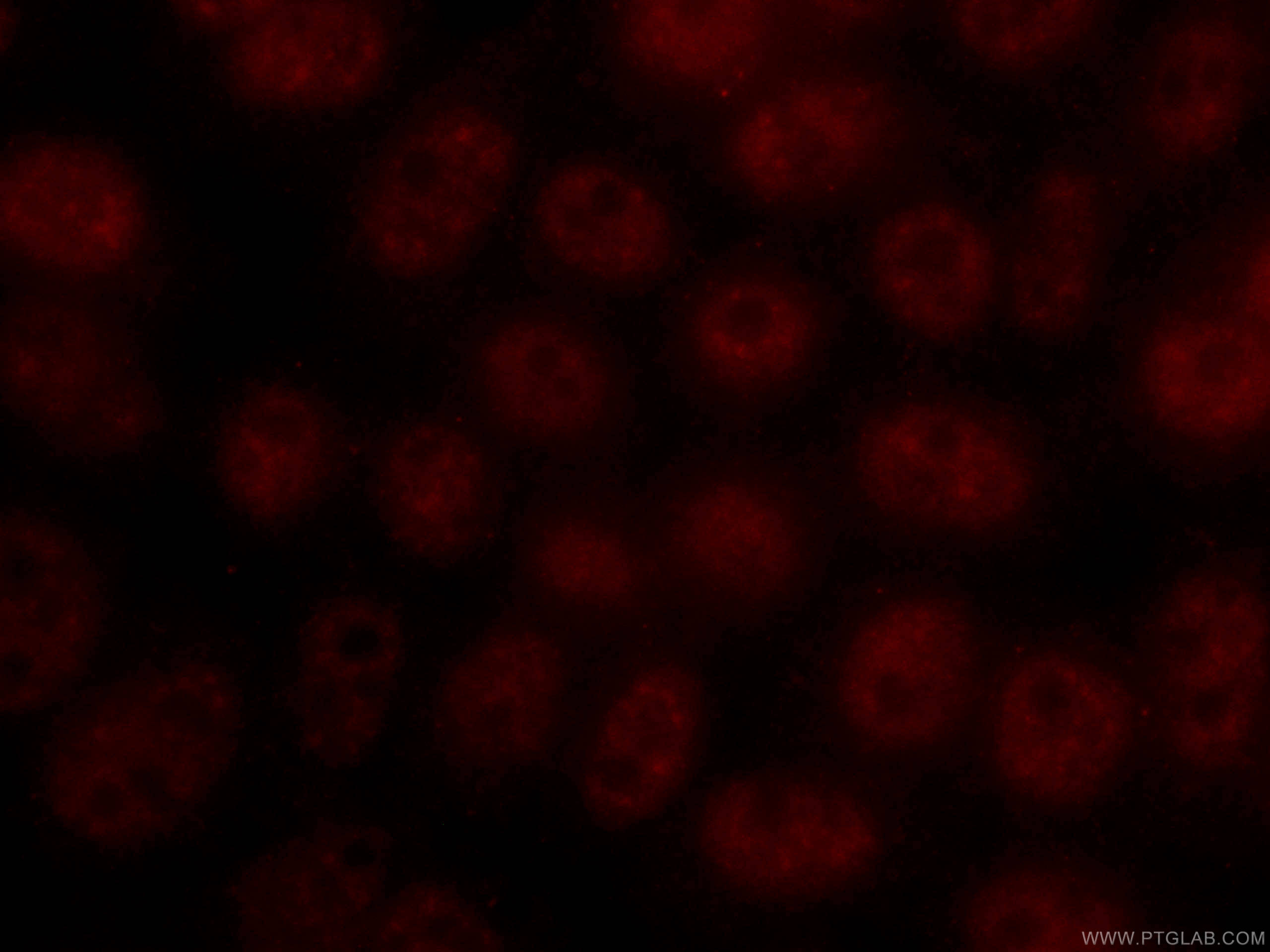 IF Staining of HeLa using CL594-66114