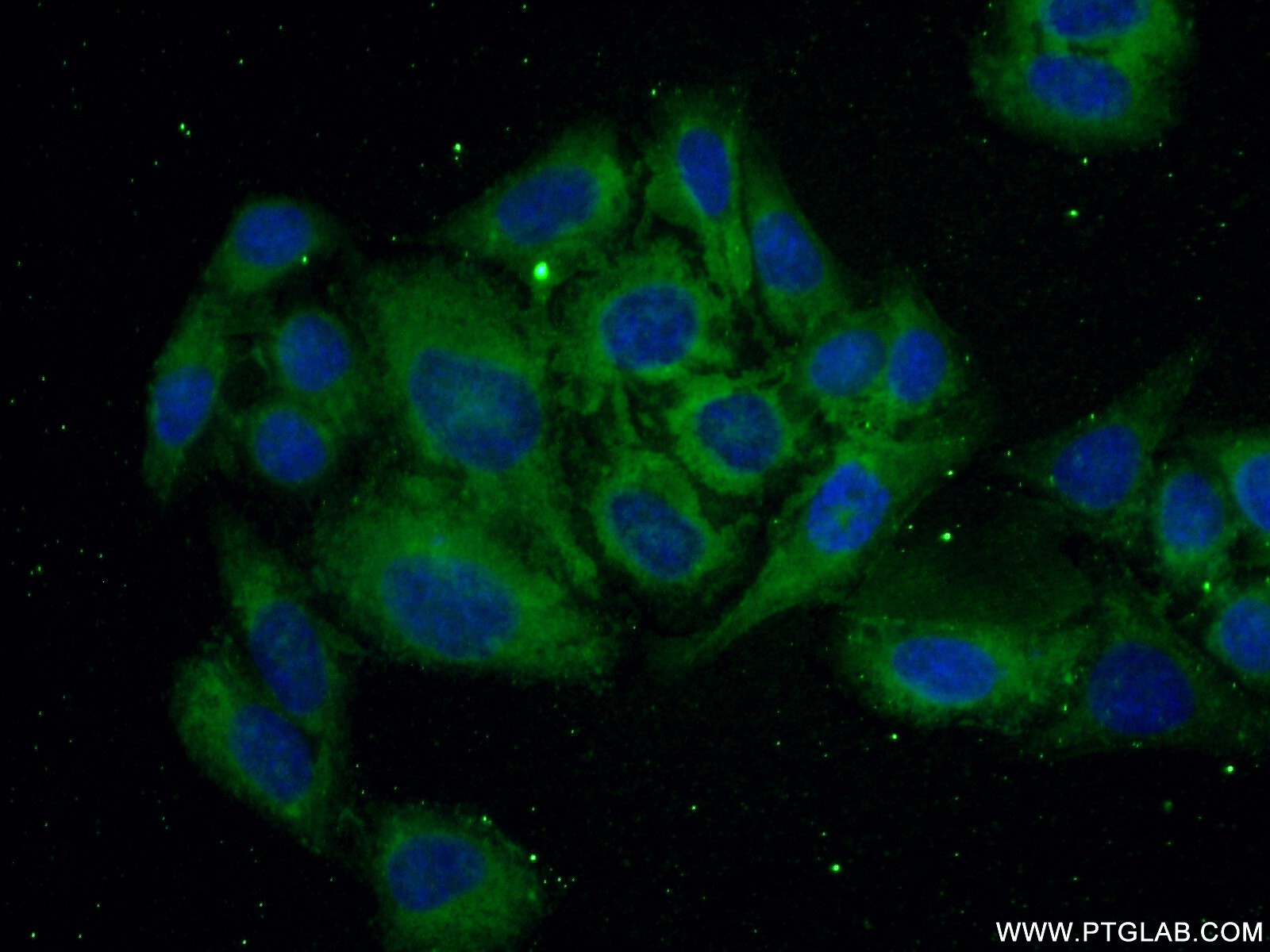 IF Staining of HepG2 using 20865-1-AP