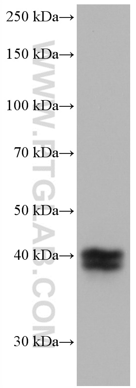 WB analysis of human placenta using 66842-1-Ig