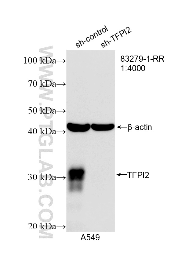WB analysis of A549 using 83279-1-RR