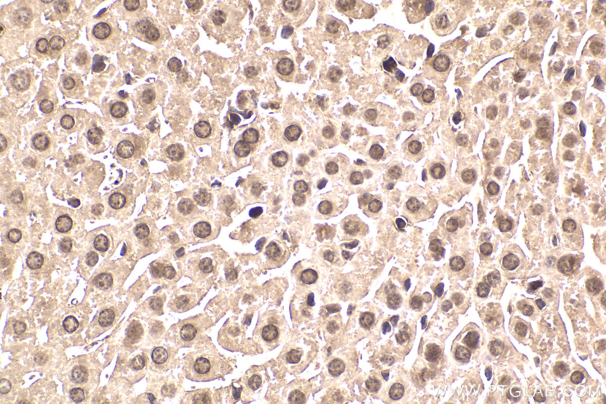 IHC staining of mouse liver using 10097-2-AP