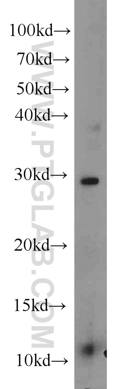 TFPT Polyclonal antibody