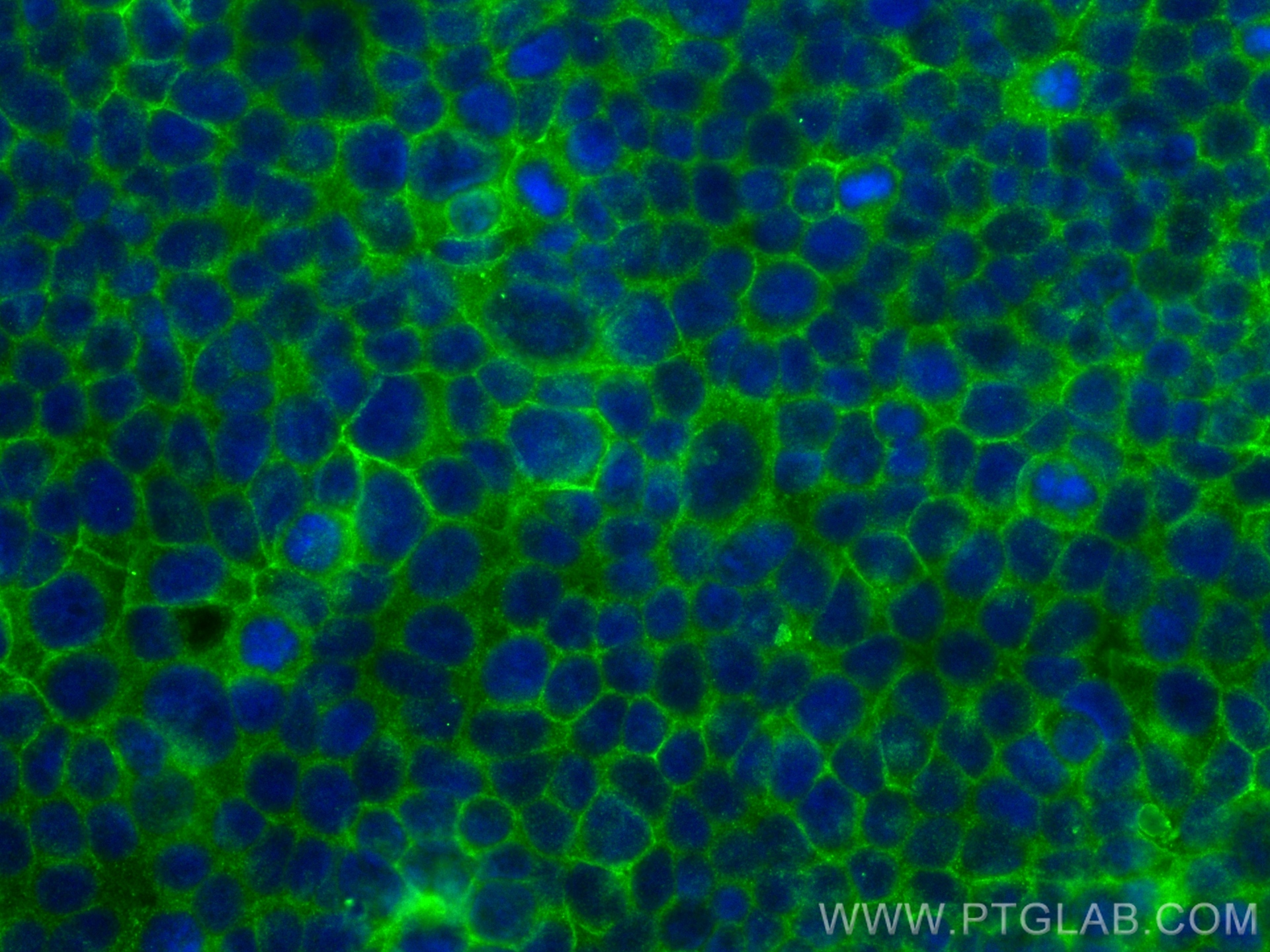 IF Staining of MCF-7 using 10084-2-AP