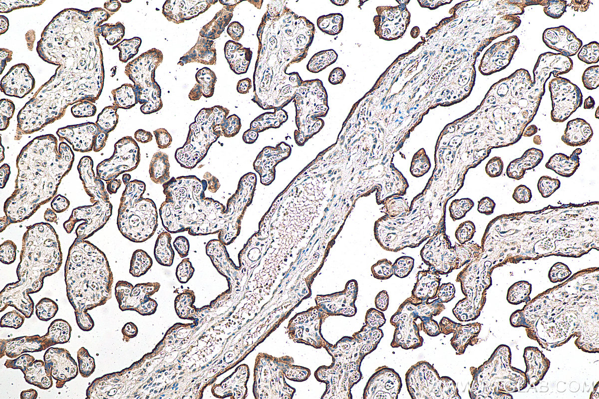 IHC staining of human placenta using 10084-2-AP