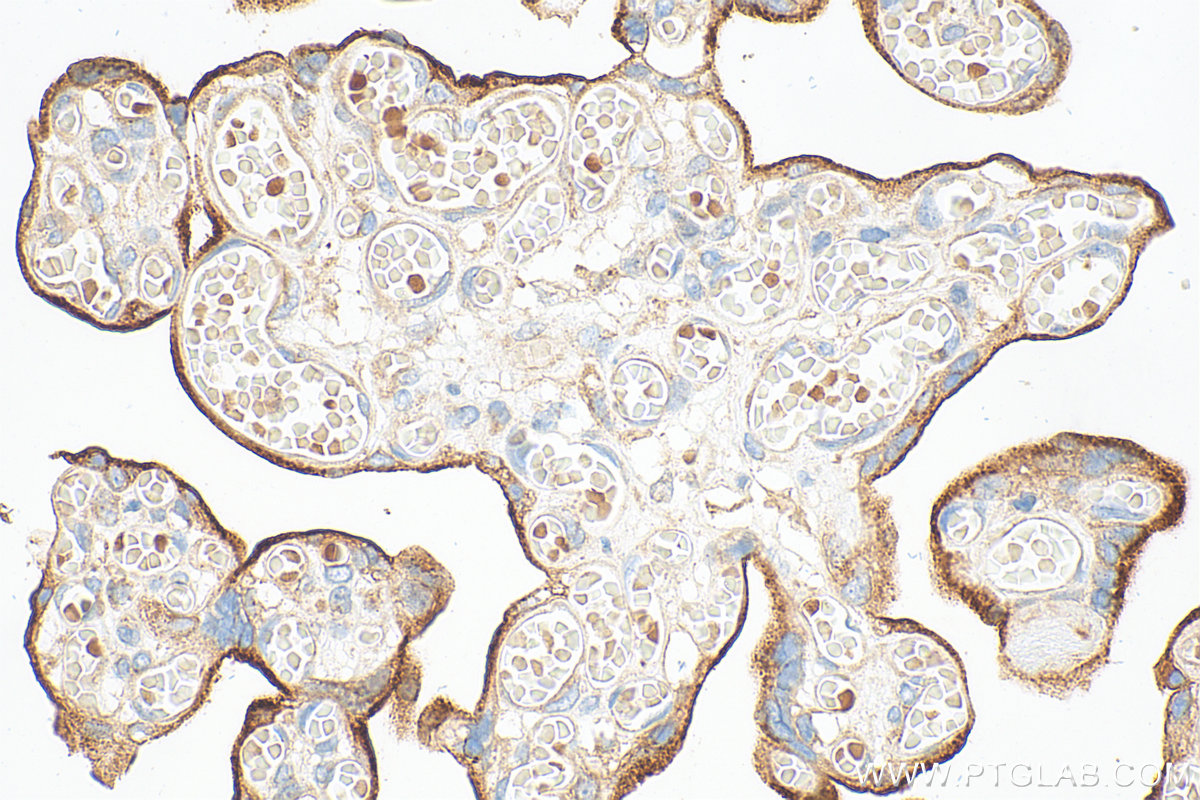IHC staining of human placenta using 10084-2-AP IHC staining of human placenta using 10084-2-AP