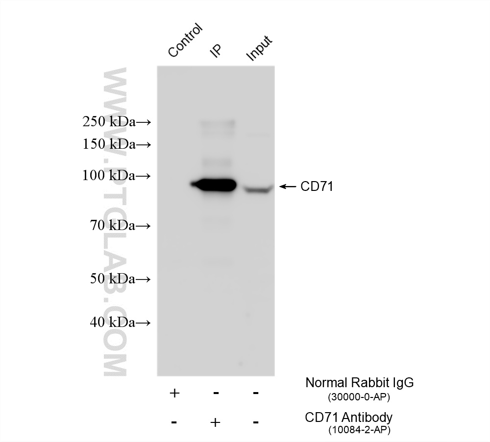 IP experiment of HeLa using 10084-2-AP