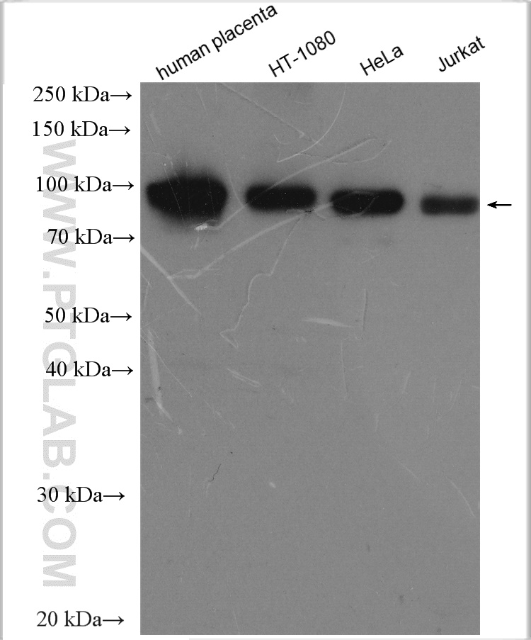 Cd71 Antibody 2 Ap Proteintech Cd71 Antibody 2 Ap Proteintech