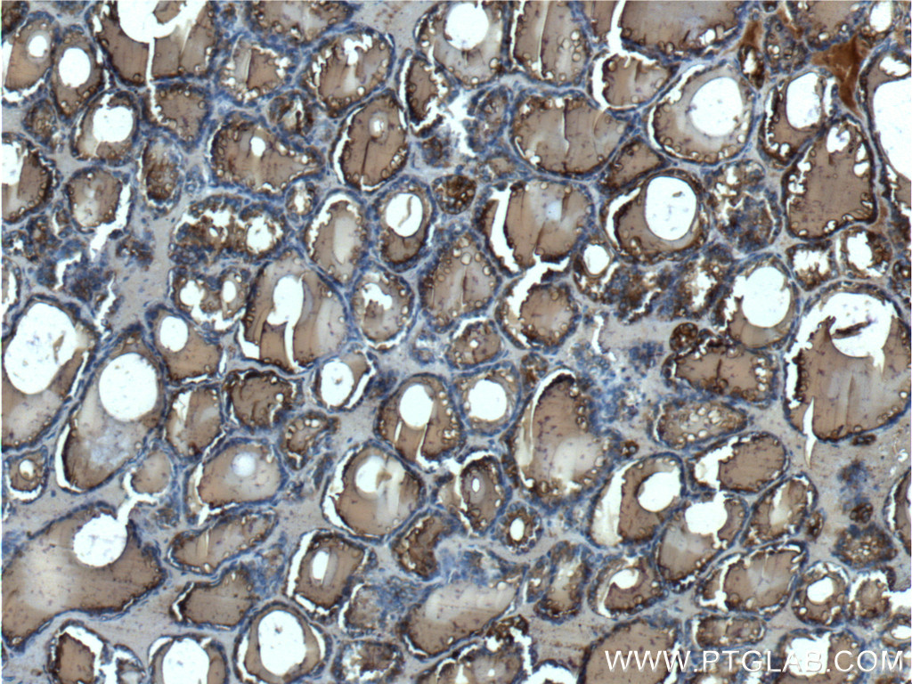 IHC staining of human thyroid using 21714-1-AP