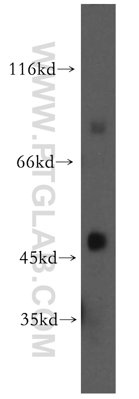 WB analysis of human kidney using 17310-1-AP