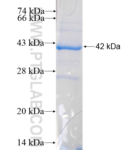 TGDS fusion protein Ag11469 SDS-PAGE