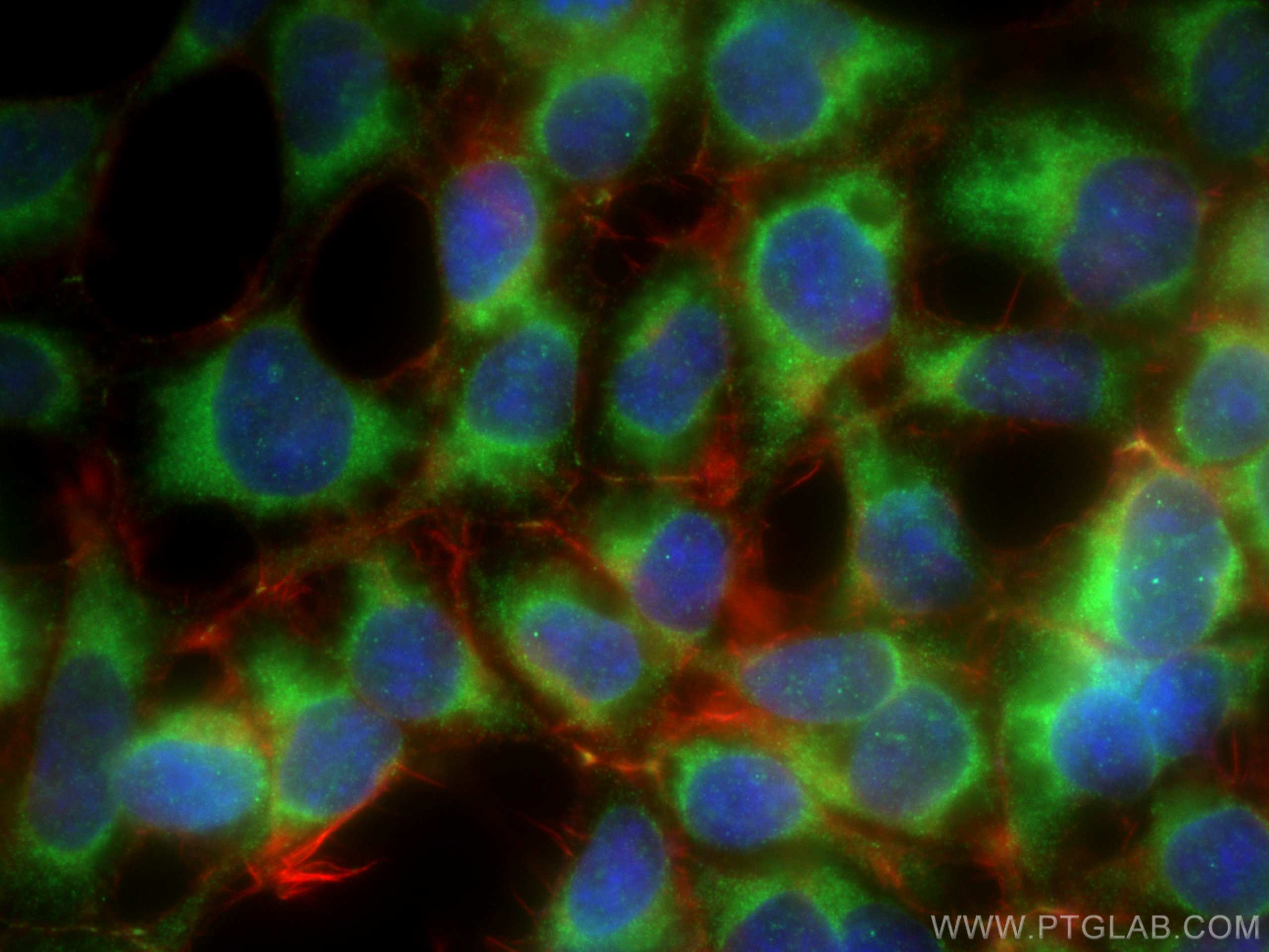 IF Staining of HEK-293 using 21898-1-AP