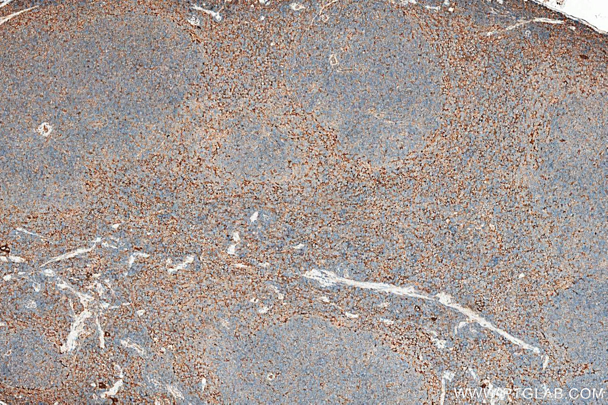 IHC staining of mouse spleen using 26155-1-AP