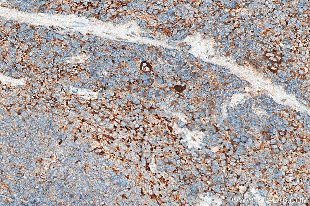 IHC staining of mouse spleen using 26155-1-AP