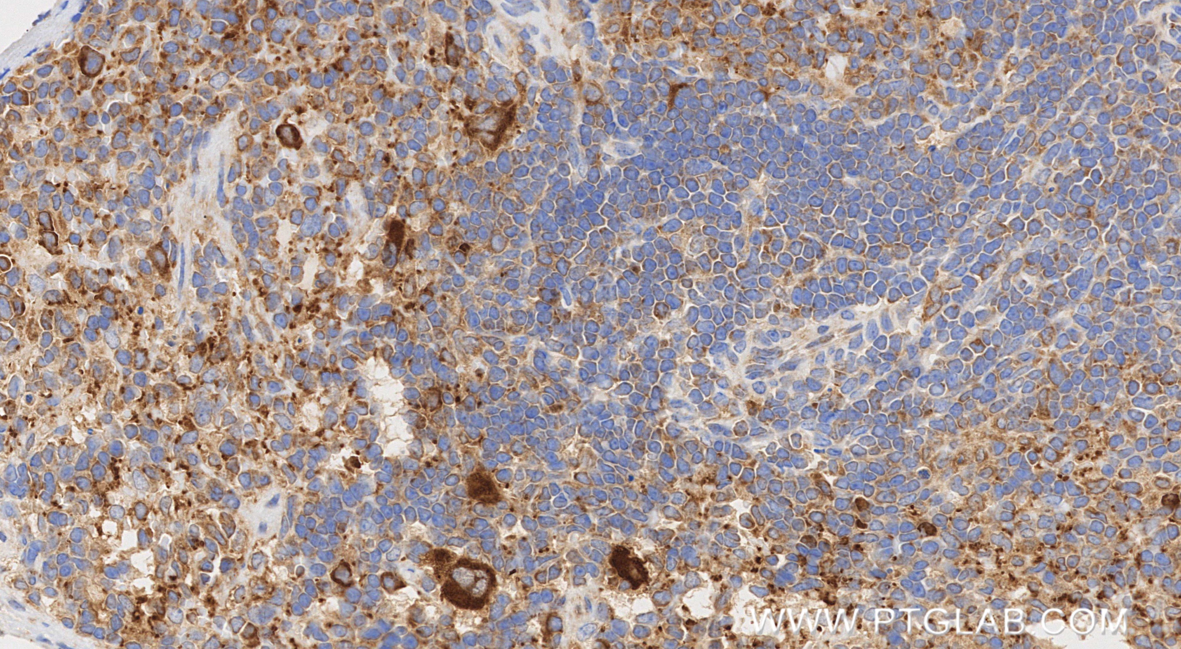 IHC staining of mouse spleen using 80458-2-RR