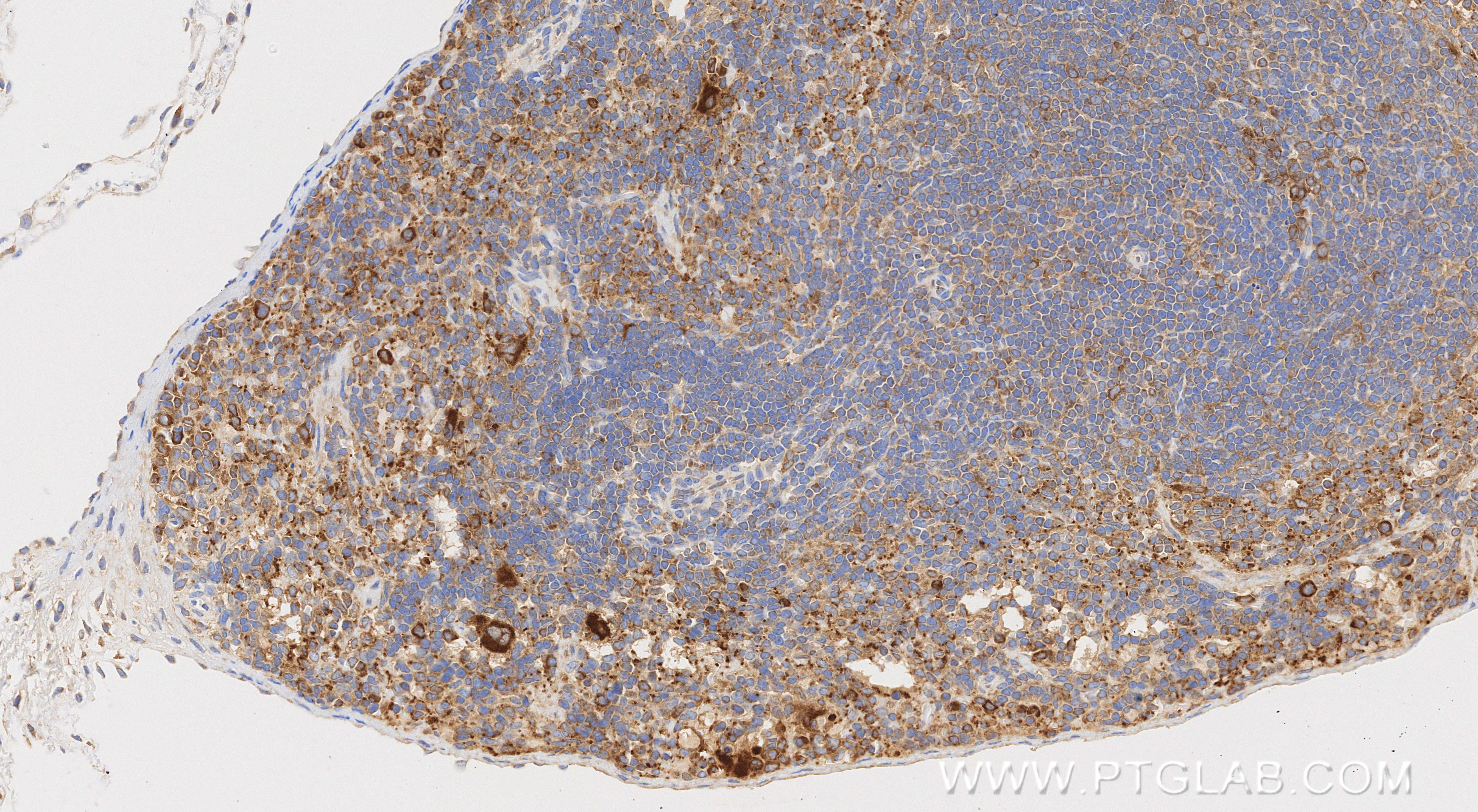 IHC staining of mouse spleen using 80458-2-RR