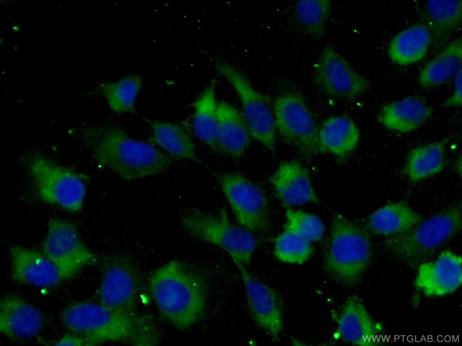 IF Staining of A431 using 22308-1-AP (same clone as 22308-1-PBS)