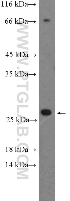 WB analysis of MCF-7 using 18978-1-AP