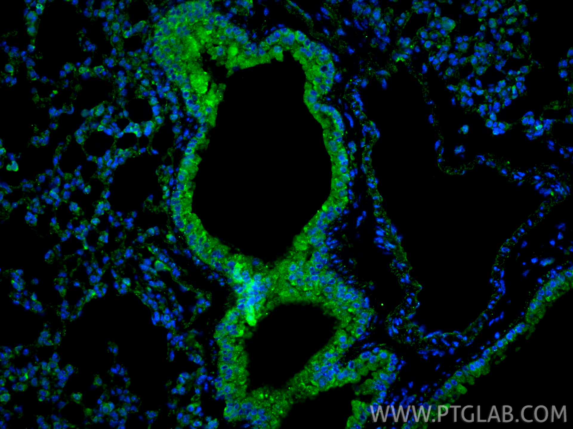 IF Staining of mouse lung using 81746-2-RR (same clone as 81746-2-PBS)