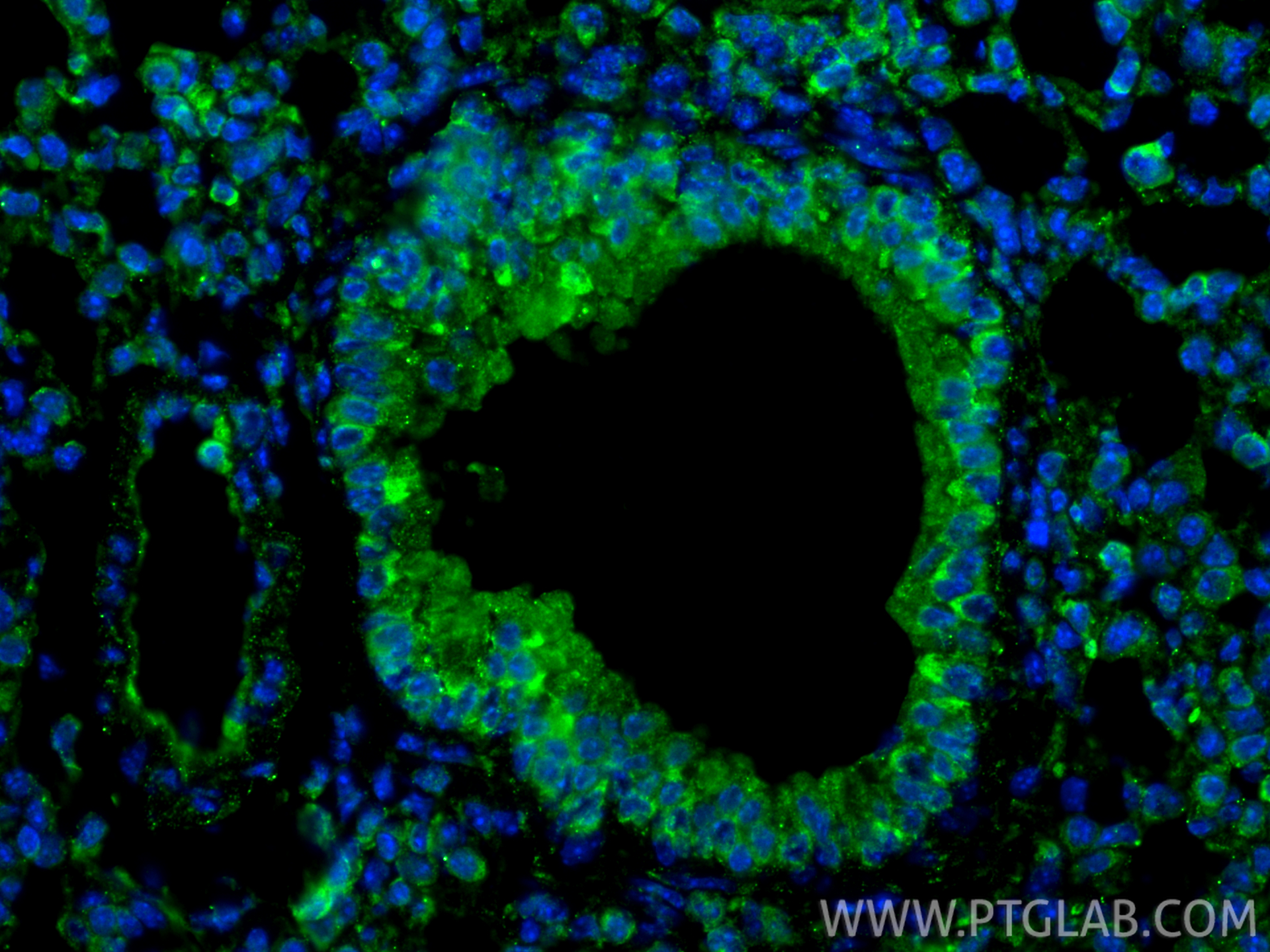 IF Staining of mouse lung using 81746-2-RR (same clone as 81746-2-PBS)