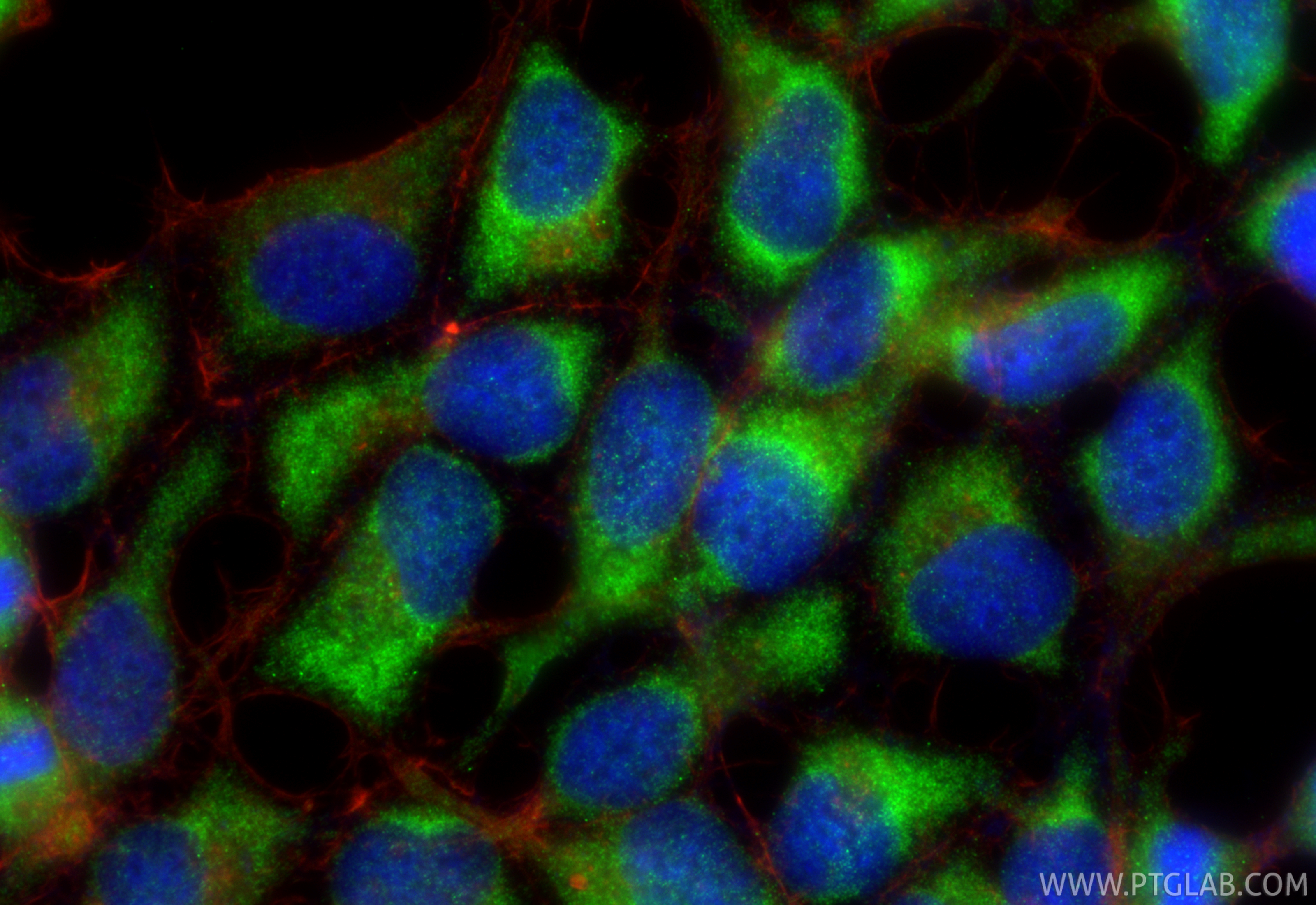 IF Staining of HEK-293 using 81746-2-RR IF Staining of HEK-293 using 81746-2-RR