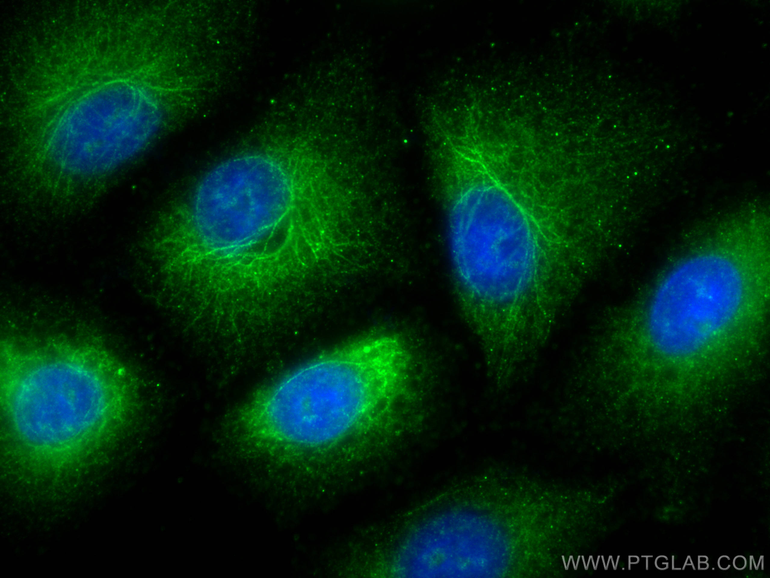 IF Staining of A549 using 10565-1-AP