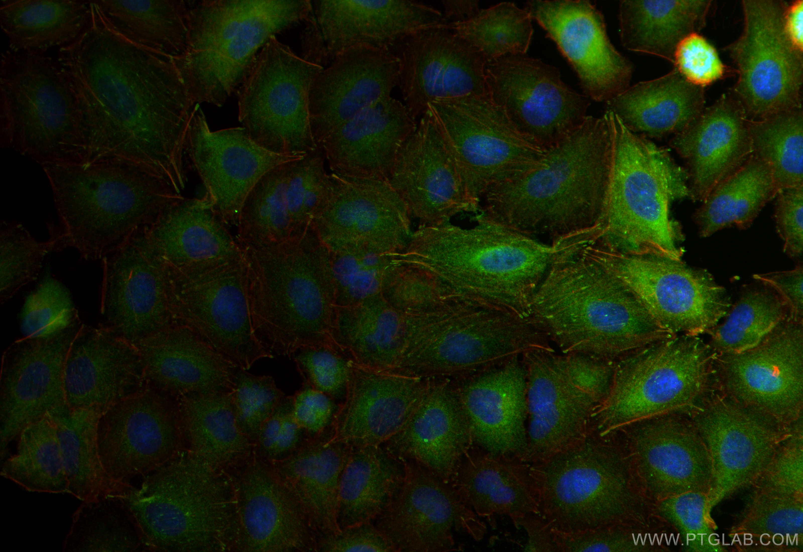 IF Staining of A549 using 10565-1-AP