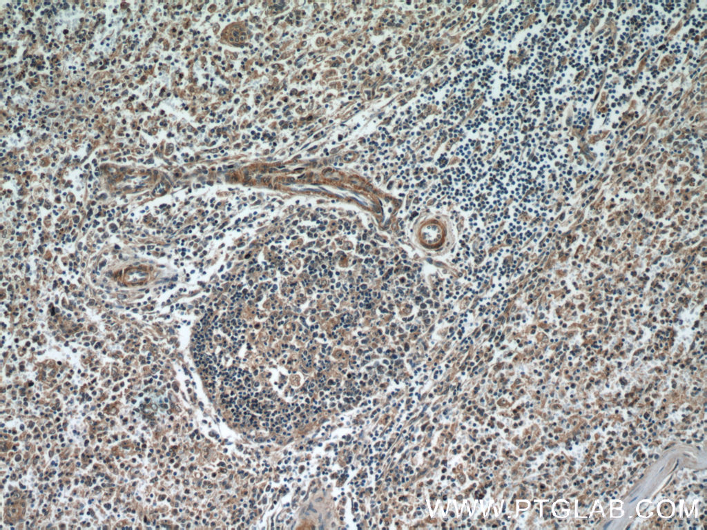 IHC staining of human spleen using 10565-1-AP