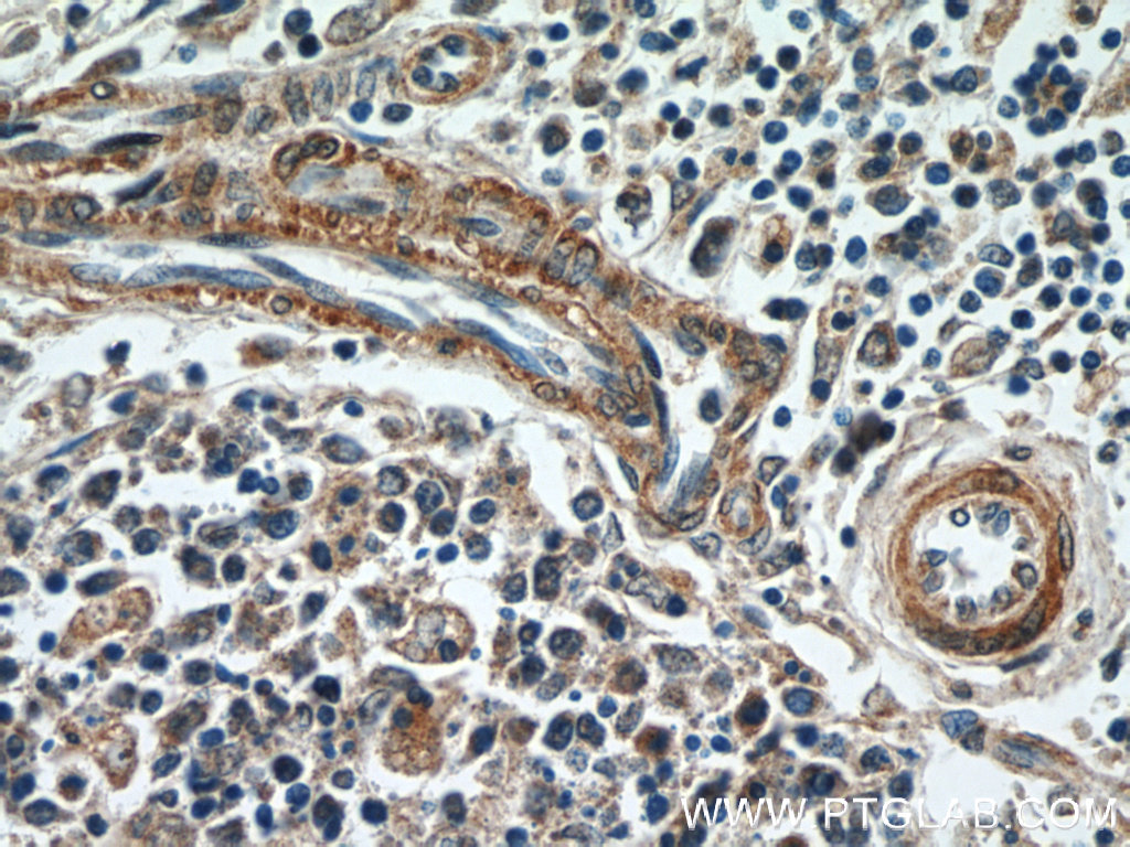 IHC staining of human spleen using 10565-1-AP