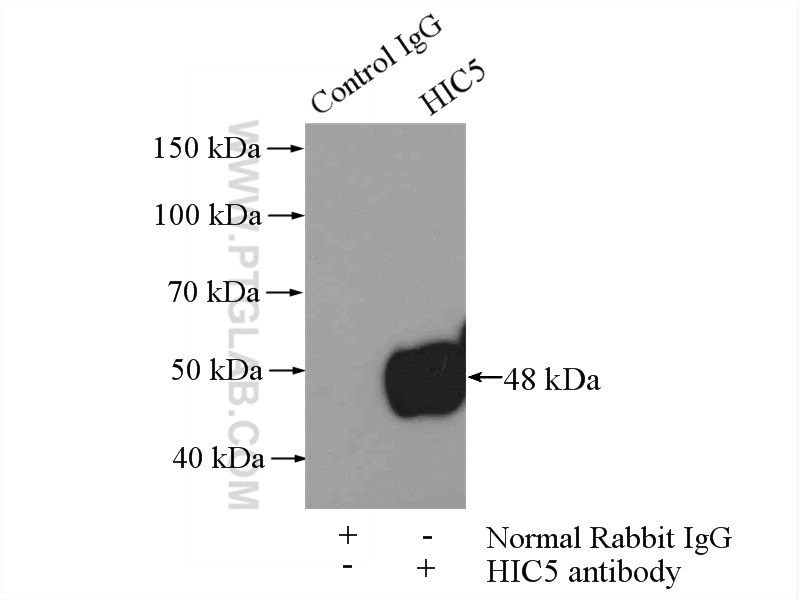 IP experiment of A431 using 10565-1-AP