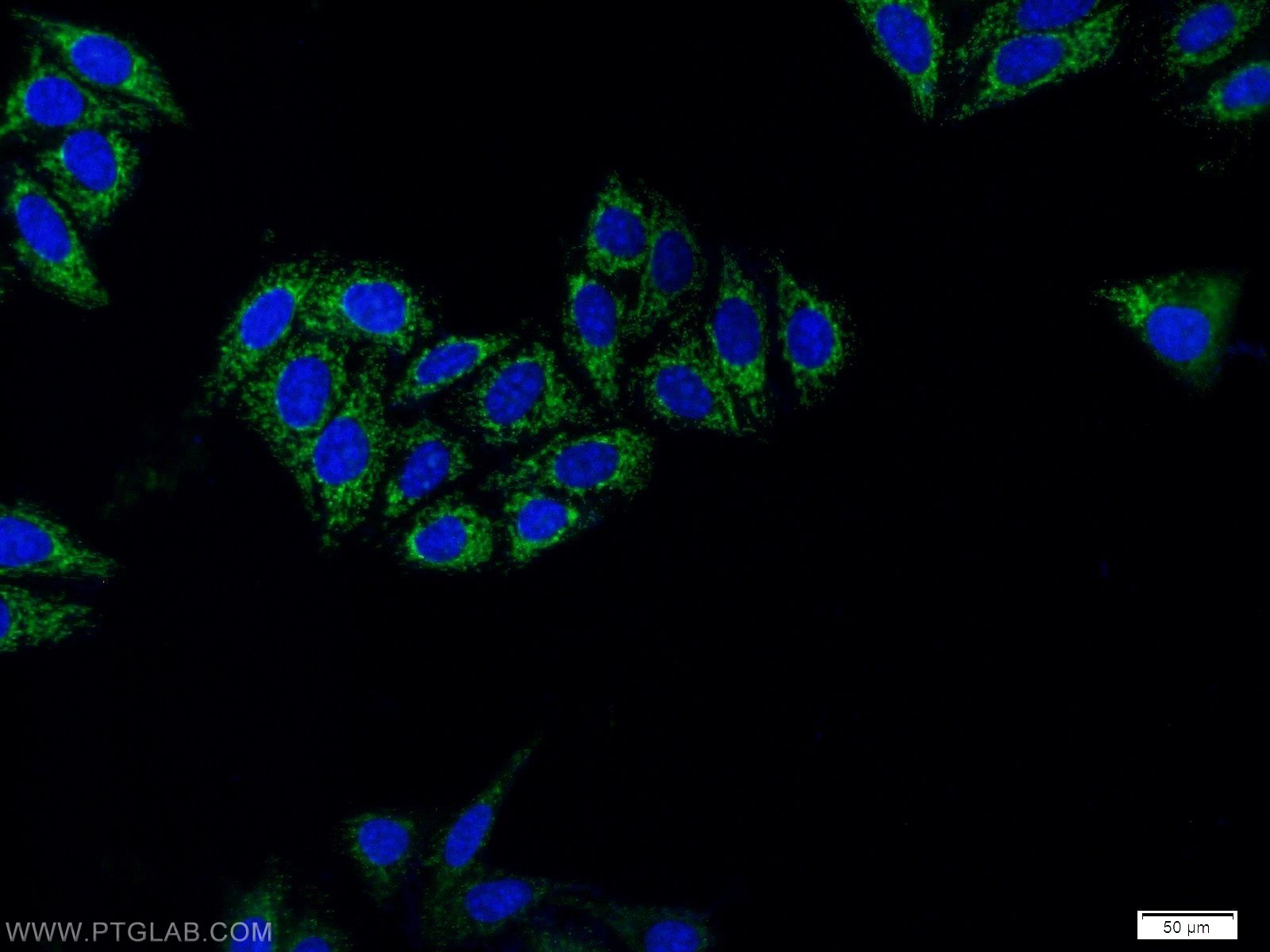 TGF beta 2-Specific Polyclonal antibody