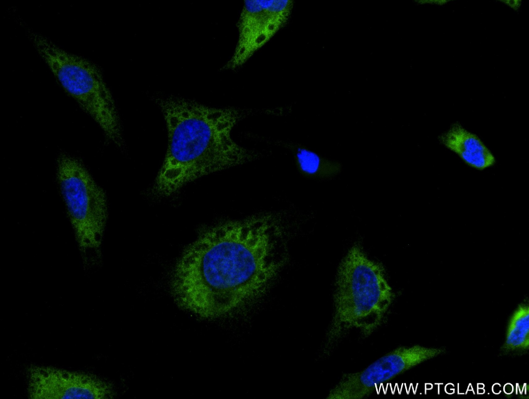 IF Staining of HeLa using 83167-5-RR
