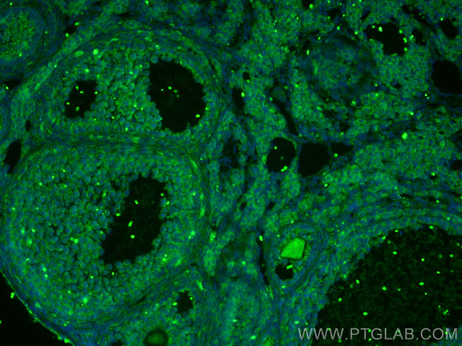 IF Staining of mouse ovary using 18942-1-AP