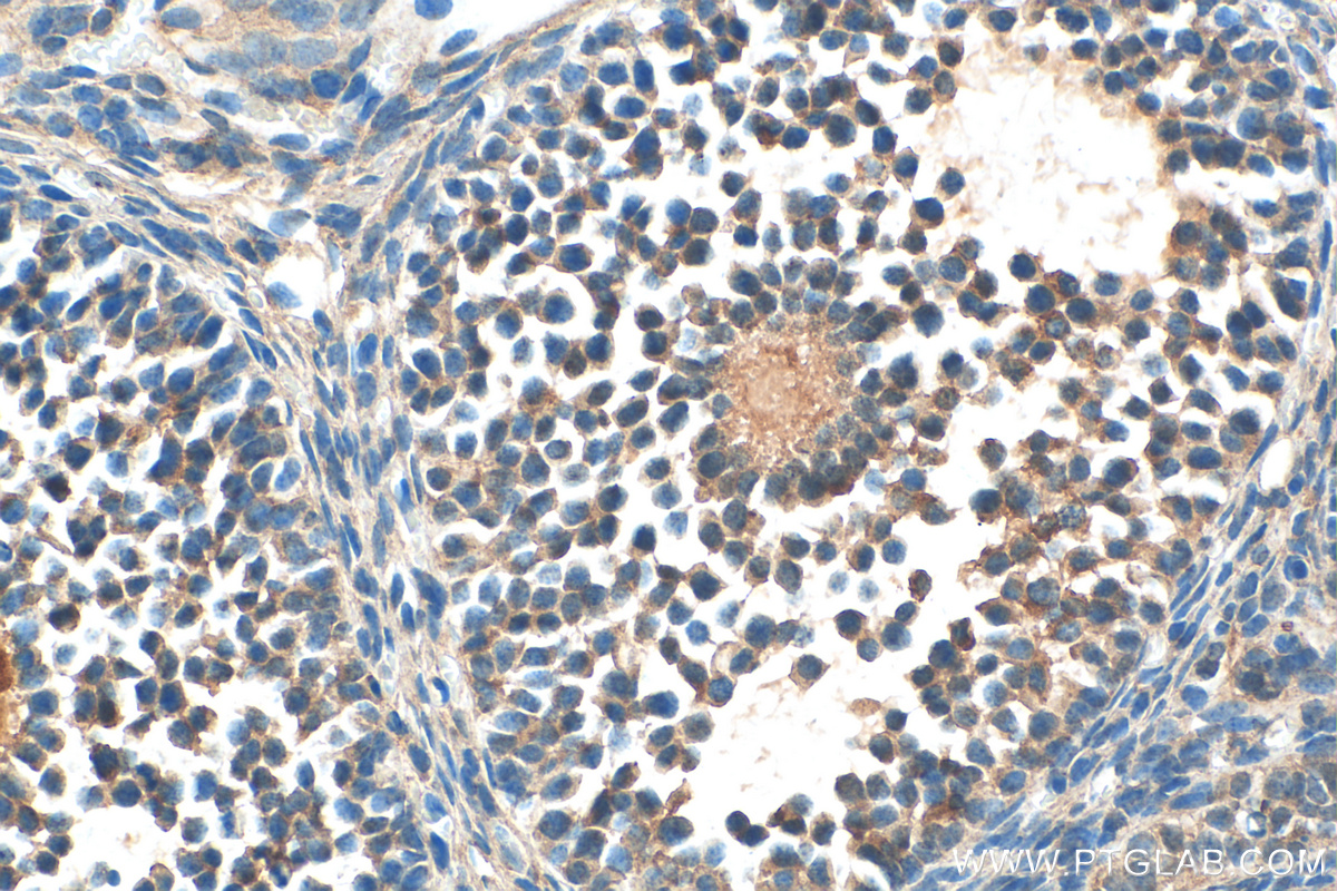 IHC staining of mouse ovary using 18942-1-AP