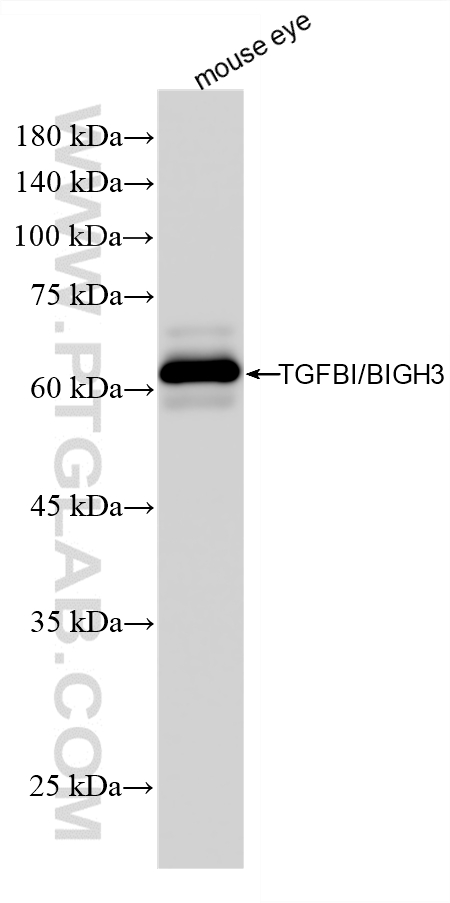 mouse eye tissue were subjected to SDS PAGE followed by western blot with <a class='green' href='/productredirect?CatalogNo=80805-3-RR' target='_blank'>80805-3-RR</a> (beta IG-H3/TGFBI antibody) at dilution of 1:5000 incubated at room temperature for 1.5 hours. This data was developed using the same antibody clone with 80805-3-PBS in a different storage buffer formulation. WB analysis of mouse eye using 80805-3-RR (same clone as 80805-3-PBS)