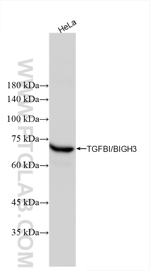 WB analysis of HeLa using 80805-4-RR (same clone as 80805-4-PBS)
