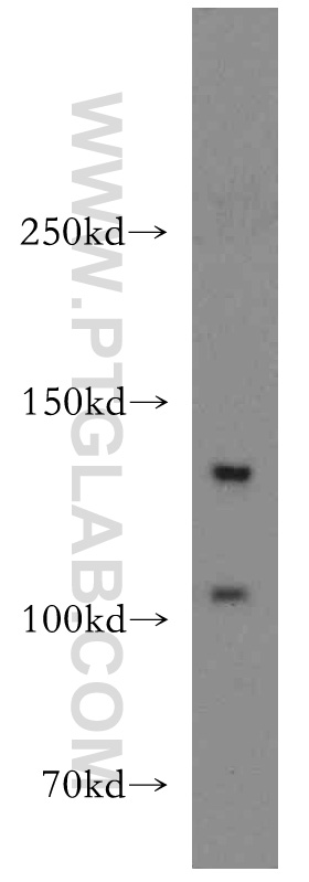 TGFBR3-Specific Polyclonal antibody