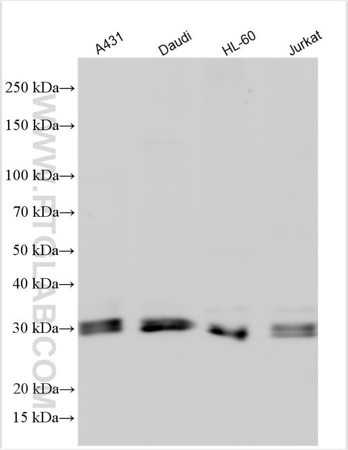 WB analysis using 11522-1-AP