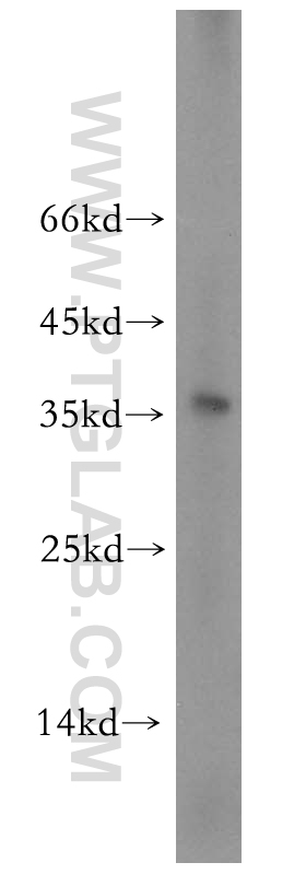 WB analysis of human testis using 17405-1-AP