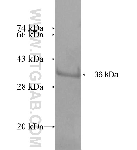 TGIF2LX fusion protein Ag11408 SDS-PAGE TGIF2LX fusion protein Ag11408 SDS-PAGE