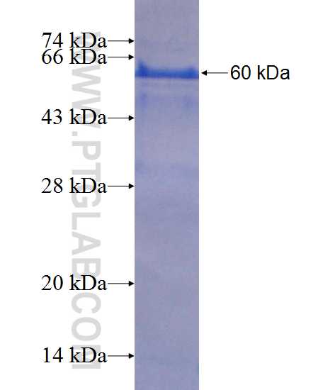 TGIF2LX fusion protein Ag11424 SDS-PAGE