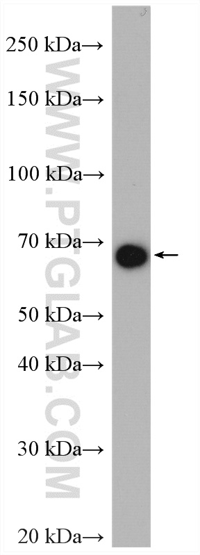 WB analysis of mouse testis using 15847-1-AP