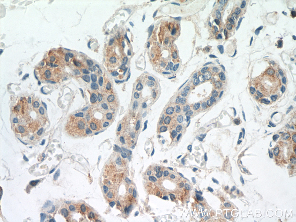 IHC staining of human skin using 25071-1-AP