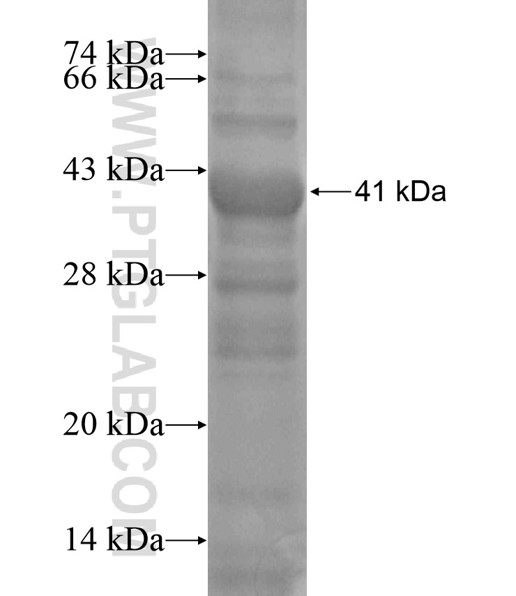 TGM5 fusion protein Ag18426 SDS-PAGE TGM5 fusion protein Ag18426 SDS-PAGE